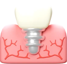 Smile Dental Clinic Muscat dental care