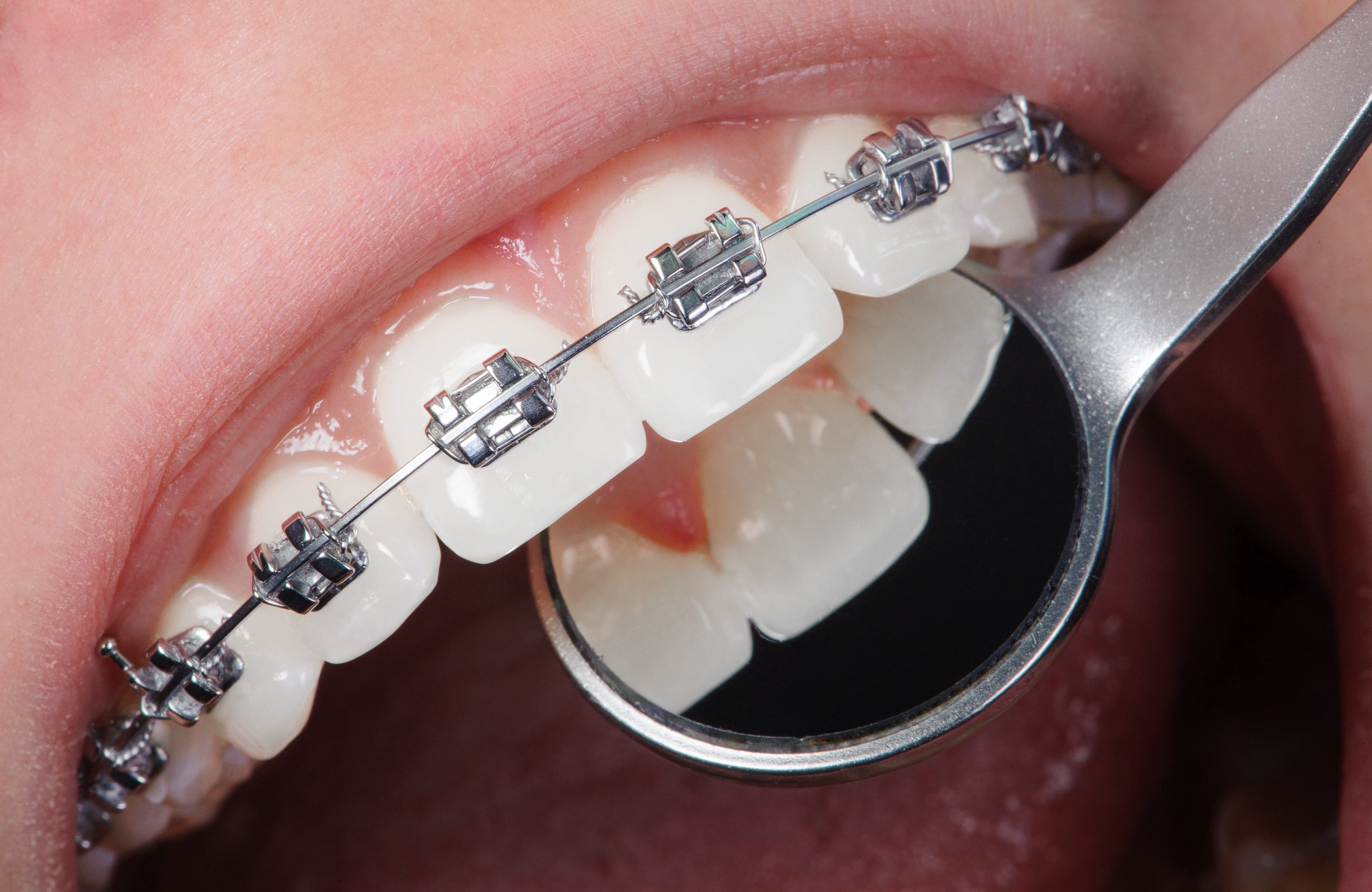 Orthodontic Specialist